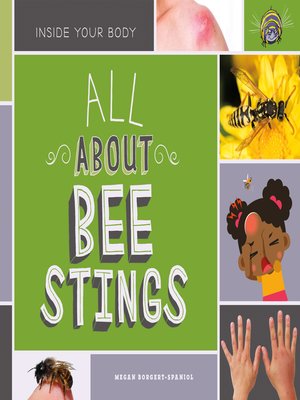 cover image of All About Bee Stings